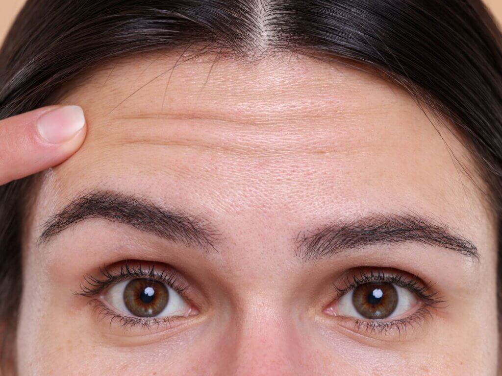 What causes wrinkles
