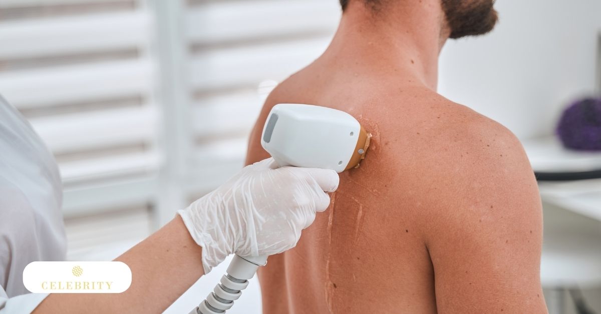 A man in a treatment room getting laser hair removal on his back