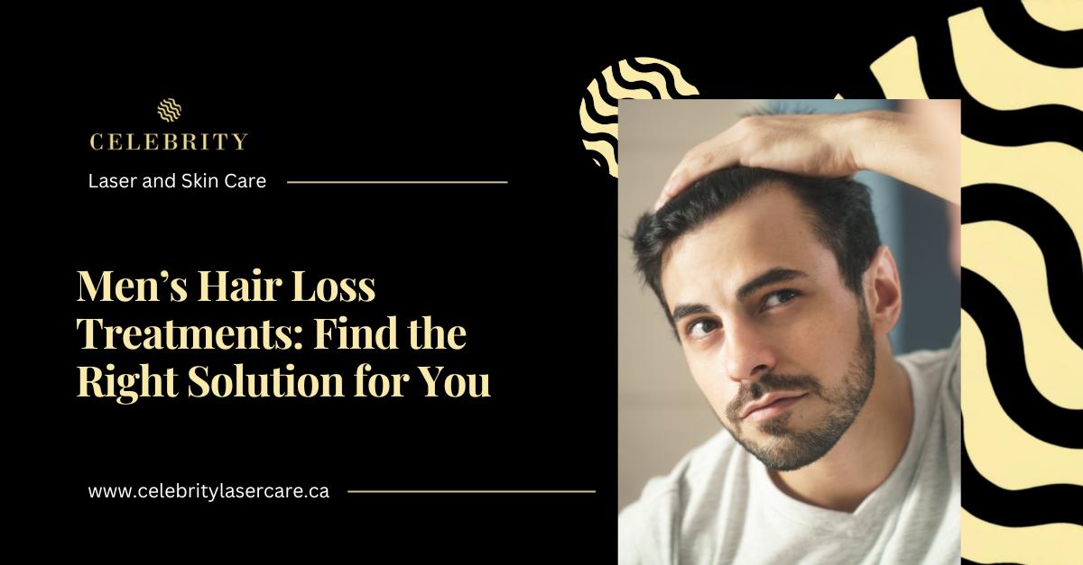 Top Hair Growth Treatments for Men: Explore Your Options