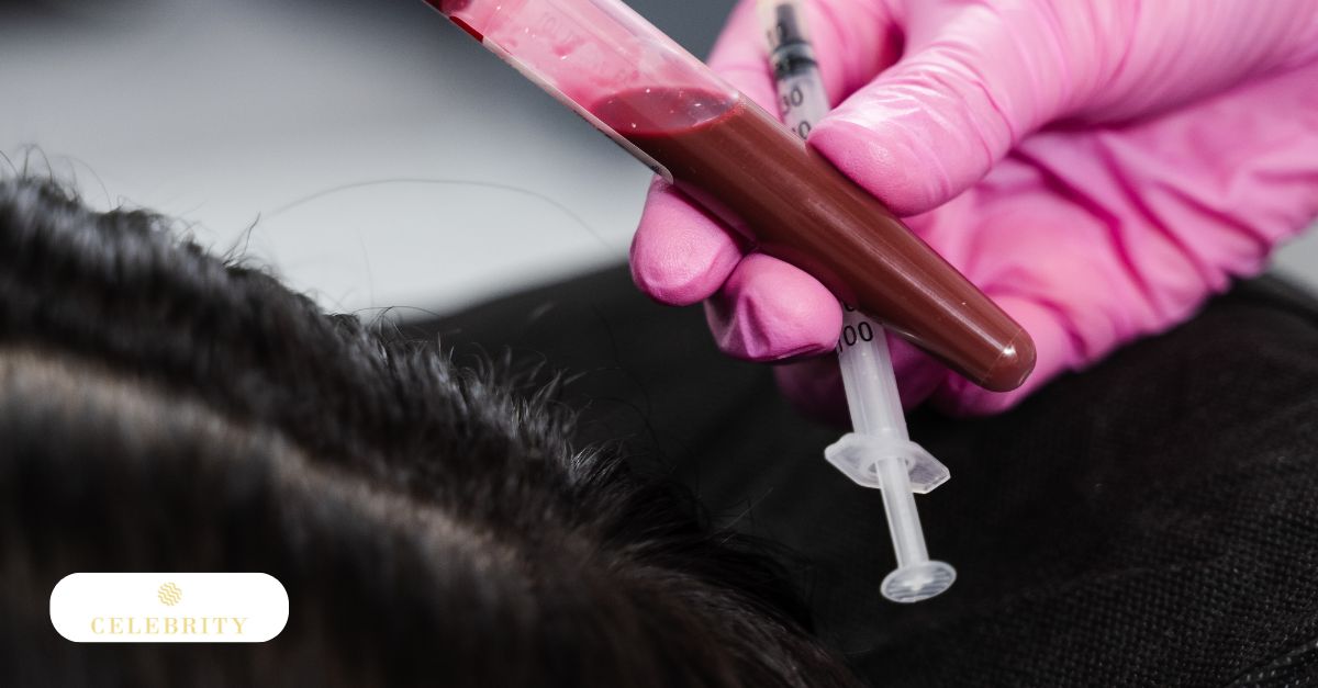 A professional in pink medical gloves holds a vial of blood and a syringe over a patient's scalp, preparing for a PRP for hair growth treatment to naturally stimulate hair density and follicle health.