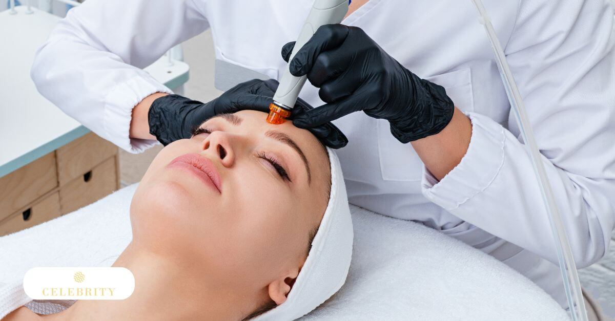 A woman undergoing microdermabrasion treatment, targeting blackheads on her skin