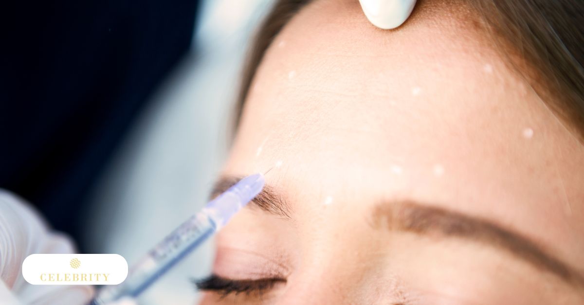 Professional Botox application by expert staff at Celebrity Laser & Skin Care.