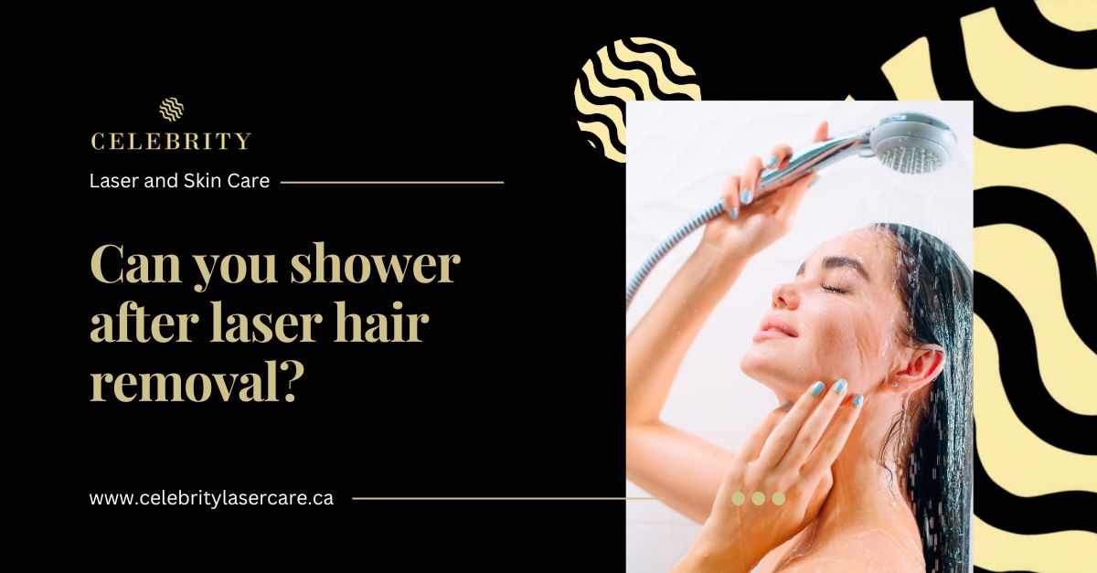 After Laser Hair Removal Care: Essential Tips for Smooth Skin