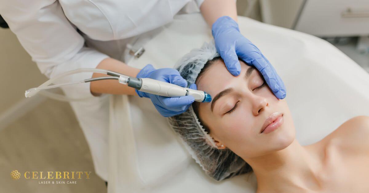A woman receiving a HydraFacial treatment for oily skin
