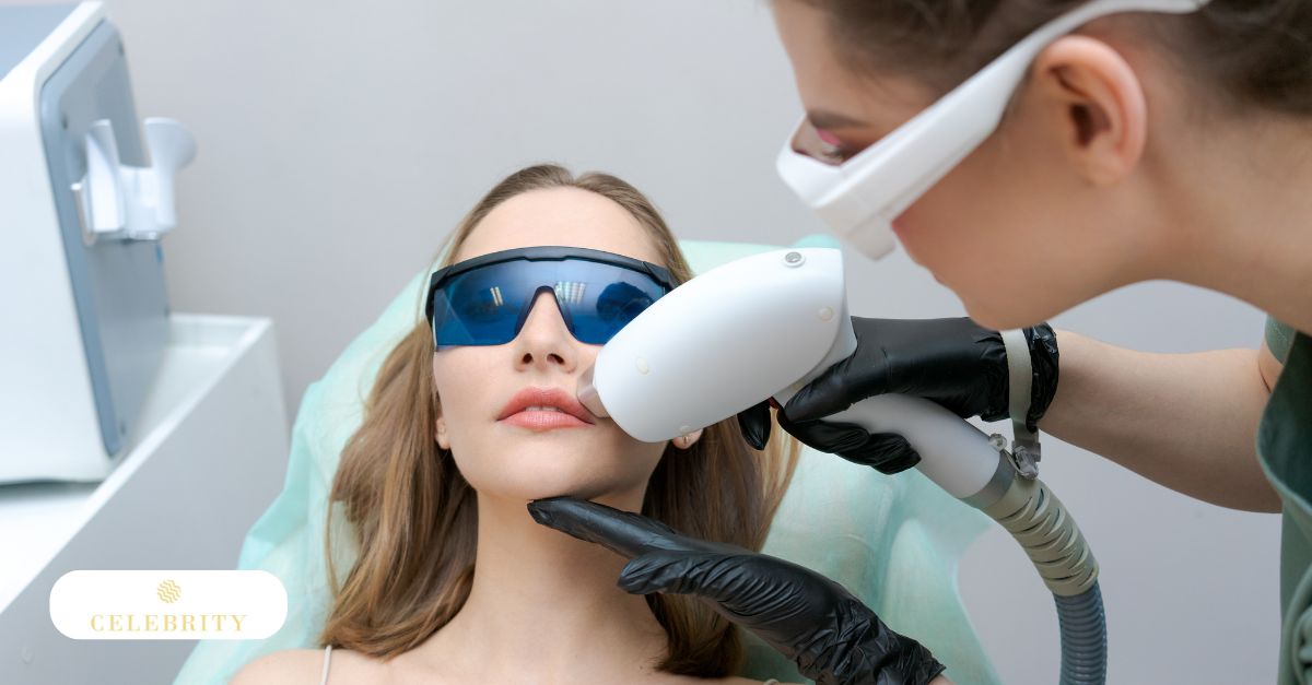 Young adult receiving facial laser hair removal treatment with protective eyewear in a professional clinical setting