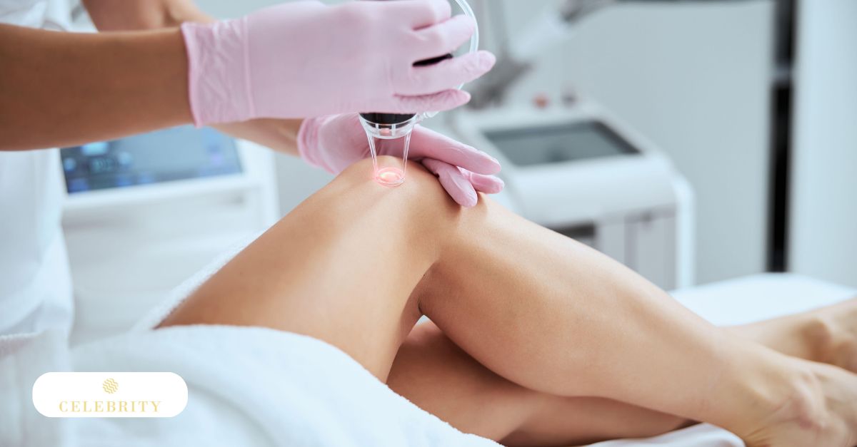 A woman undergoing laser treatment for hair removal at Celebrity Laser & Skin Care clinic