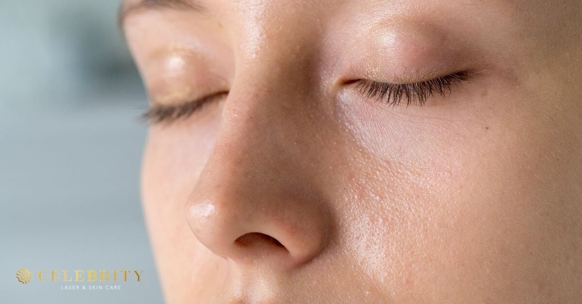 A face with oily skin