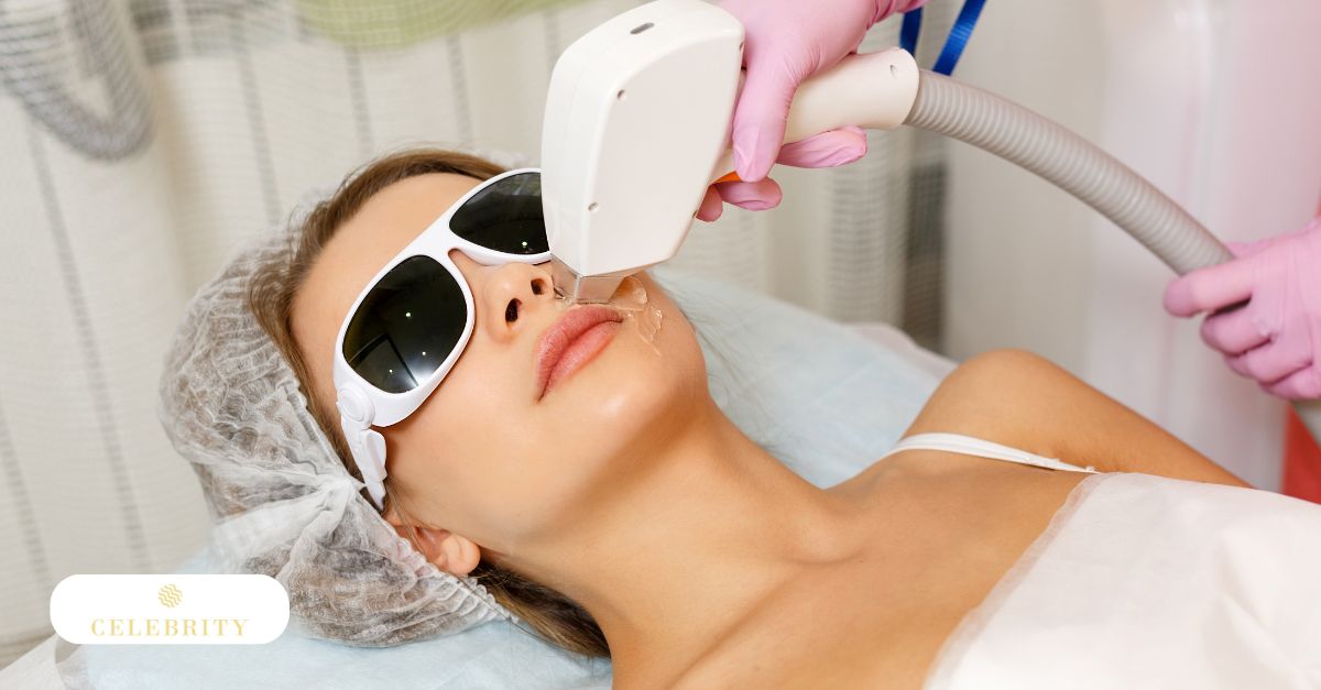 A woman undergoing facial laser hair removal treatment in a clinical setting