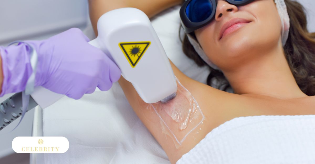 Understanding the shedding phase after laser hair removal