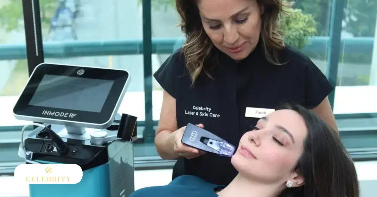 A woman receiving Morpheus8 at Celebrity Laser & Skin Care for acne treatment