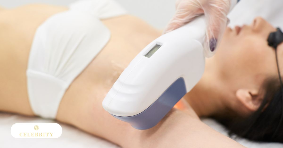 Full body laser hair removal in Vancouver