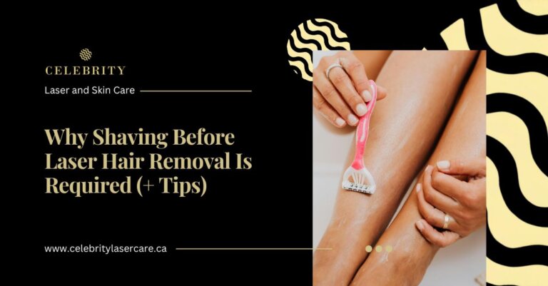 Why Shaving Before Laser Hair Removal Is a Must (+Prep Tips)