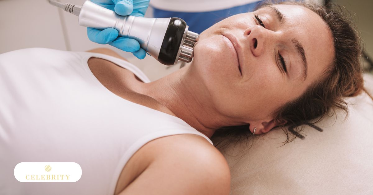 A woman receiving RF skin tightening treatment focused on skin laxity.