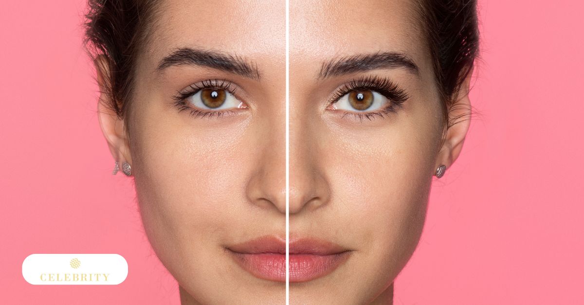 Before and after photos showcasing a woman's eyes following an eyebrow lift filler treatment
