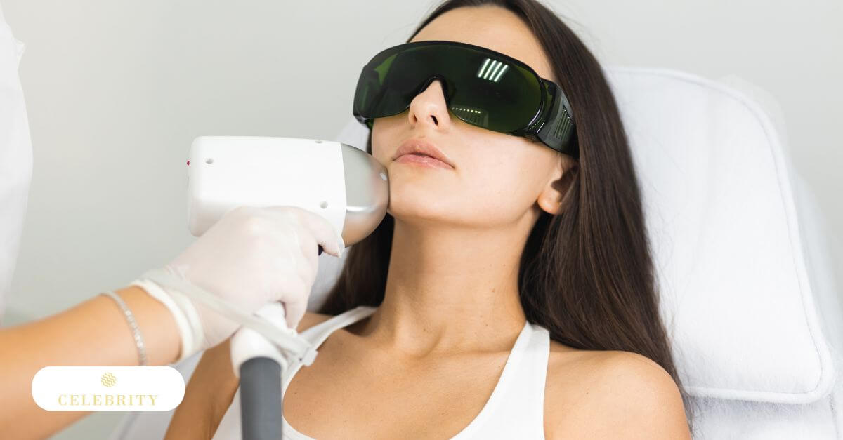Woman undergoing facial laser hair removal with a handheld laser device applied to her cheek