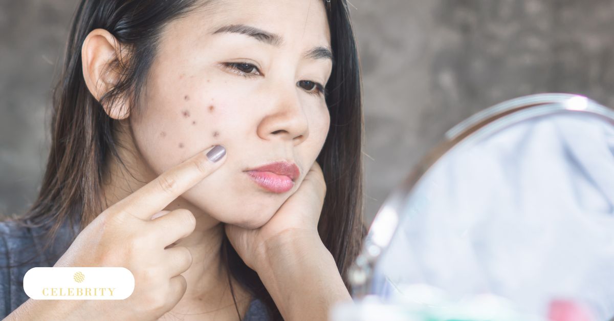 A woman with visible acne scars looking at her reflection in the mirror after a treatment