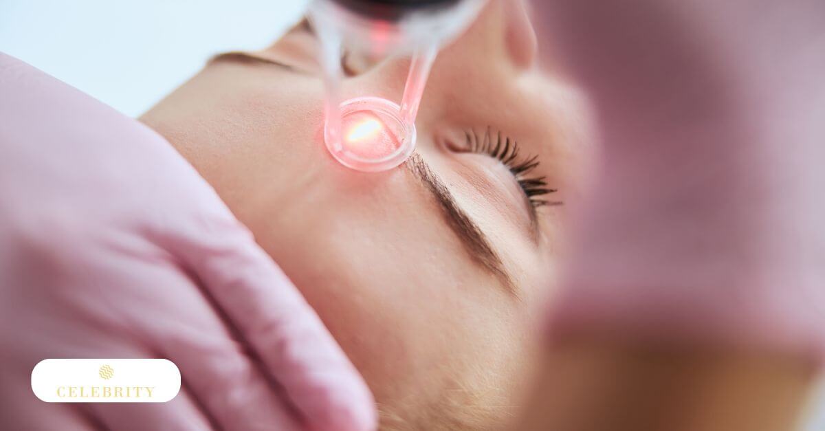 What clients with blonde hair should expect from laser hair removal results and treatment timelines