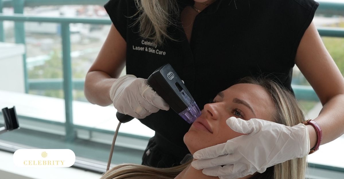 Morpheus8 radiofrequency microneedling technology used for skin tightening and rejuvenation.