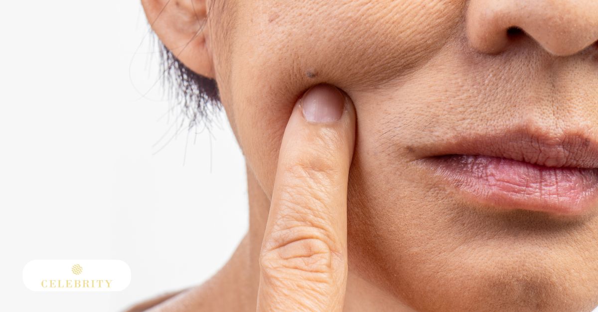 Close-up image of a woman's face featuring prominent wrinkles, emphasizing skin laxity and the aging process