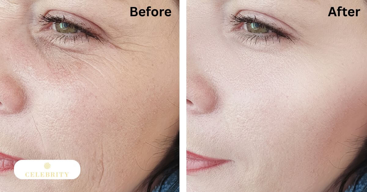 Results of SkinCeuticals C E Ferulic on dark spots, fine lines, and glow