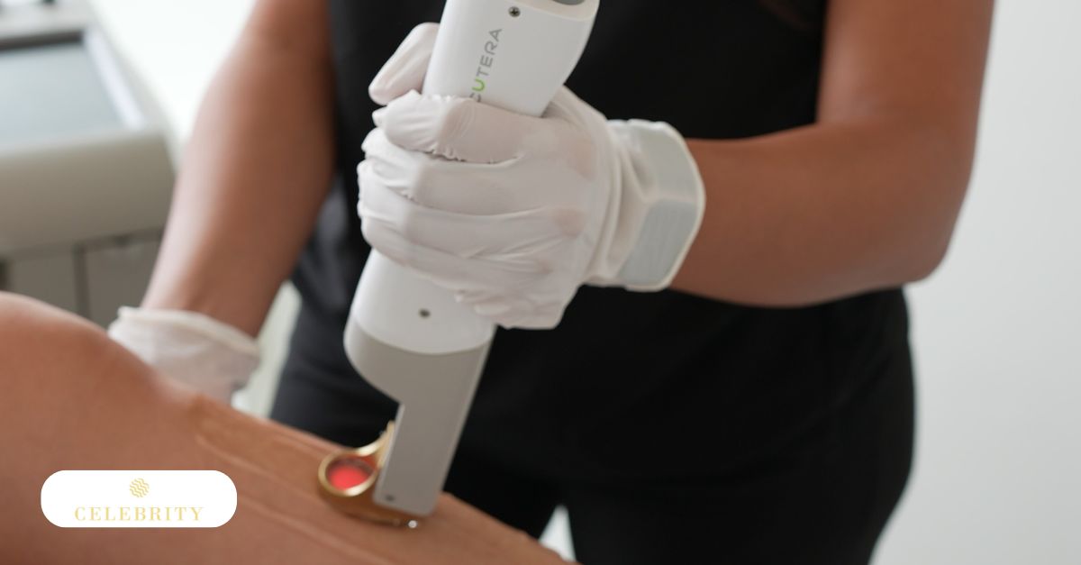 Specialist holding a white handheld laser device against a patient's light-skinned leg for hair removal.