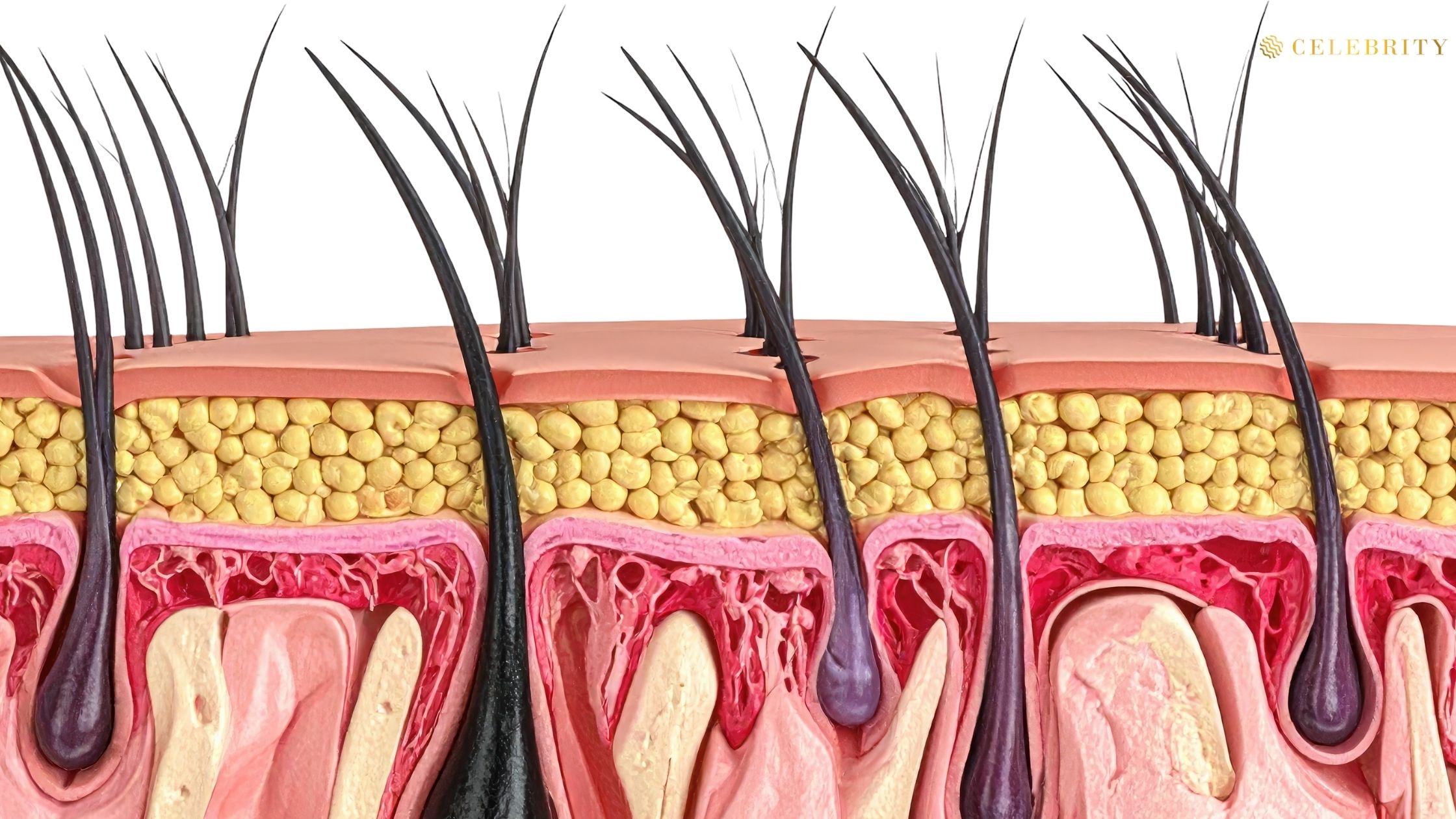 A picture showcasing Hair Follicles and the way they are in our body