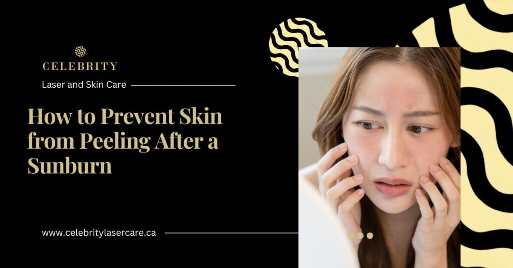 How to Prevent Skin from Peeling After a Sunburn