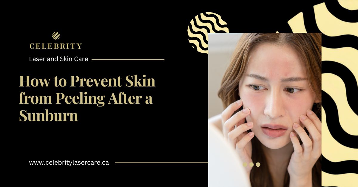 How to Prevent Skin from Peeling After a Sunburn