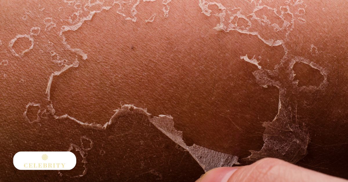 Woman examining facial skin in mirror, highlighting peeling causes like dryness, irritation, and sun damage.