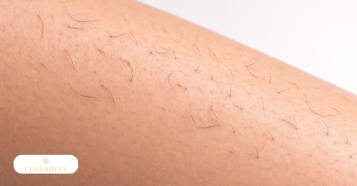 Close-up of fine hair regrowth on skin, illustrating why hair keeps growing after laser removal during treatment cycles.