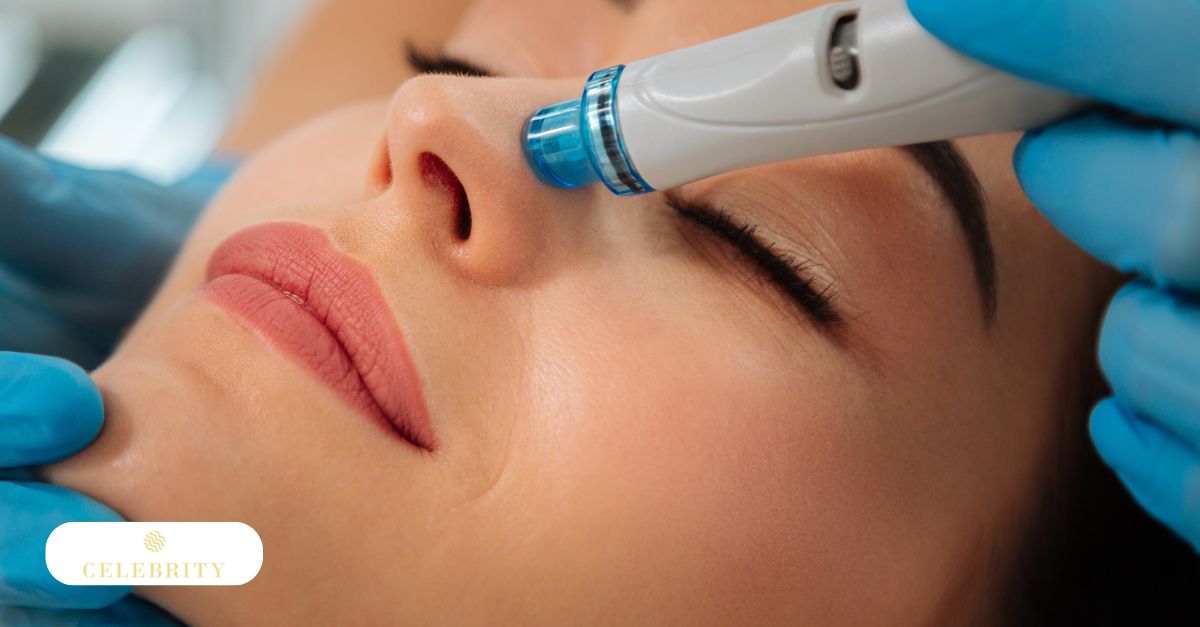 Gentle HydraFacial treatment being performed with a handheld device, illustrating routine skincare care during pregnancy.