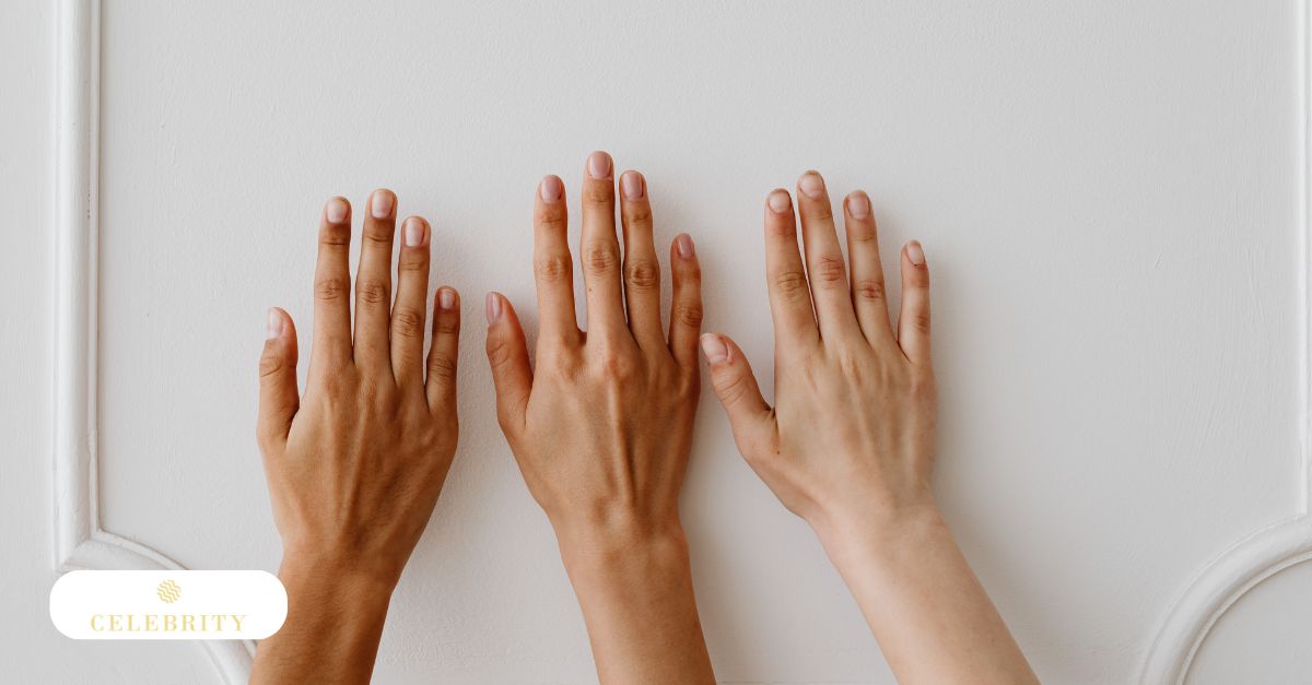 Three hands showing different skin tones for Fitzpatrick skin type comparison