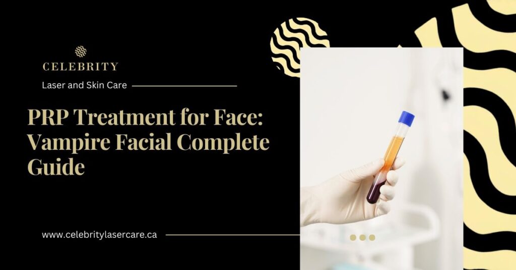 Vampire facial PRP therapy preparation with platelet-rich plasma sample.