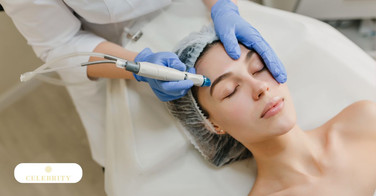 Practitioner performing Morpheus8 treatment on woman's forehead and brow area during skin tightening procedure