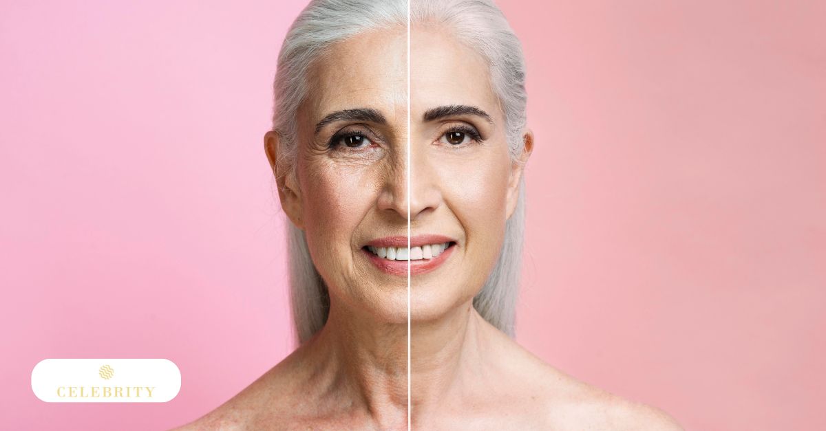 Split-face comparison of mature woman showing aged skin on left versus smoother, lifted skin on right