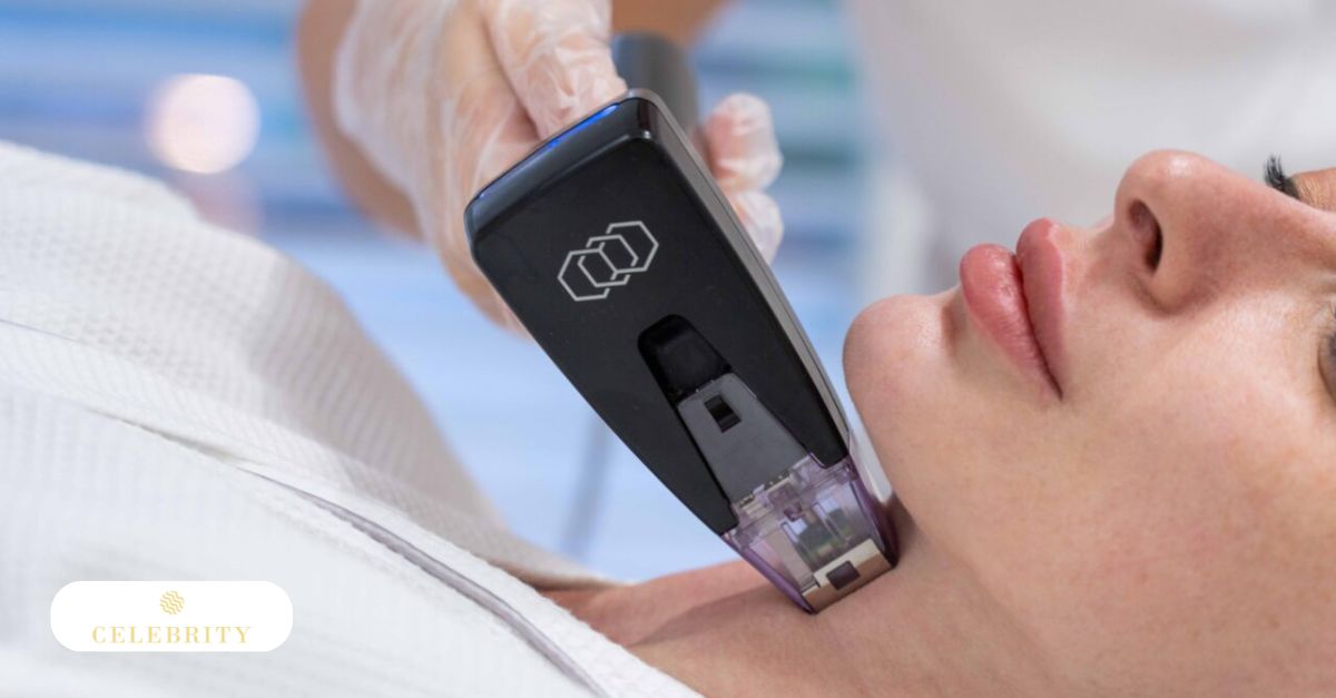 Close-up of Morpheus8 device applying skin tightening treatment to patient's jawline and neck area