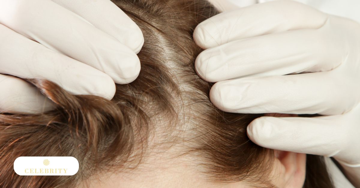 Female scalp thinning and reduced hair density associated with female pattern hair loss
