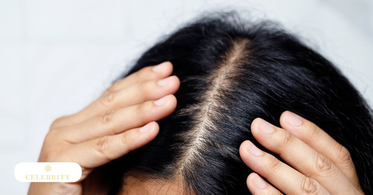 Close-up of scalp and hair part illustrating natural hair growth and hair thinning patterns