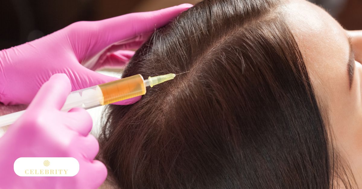 Hair restoration procedure using PRP injections to stimulate natural hair growth