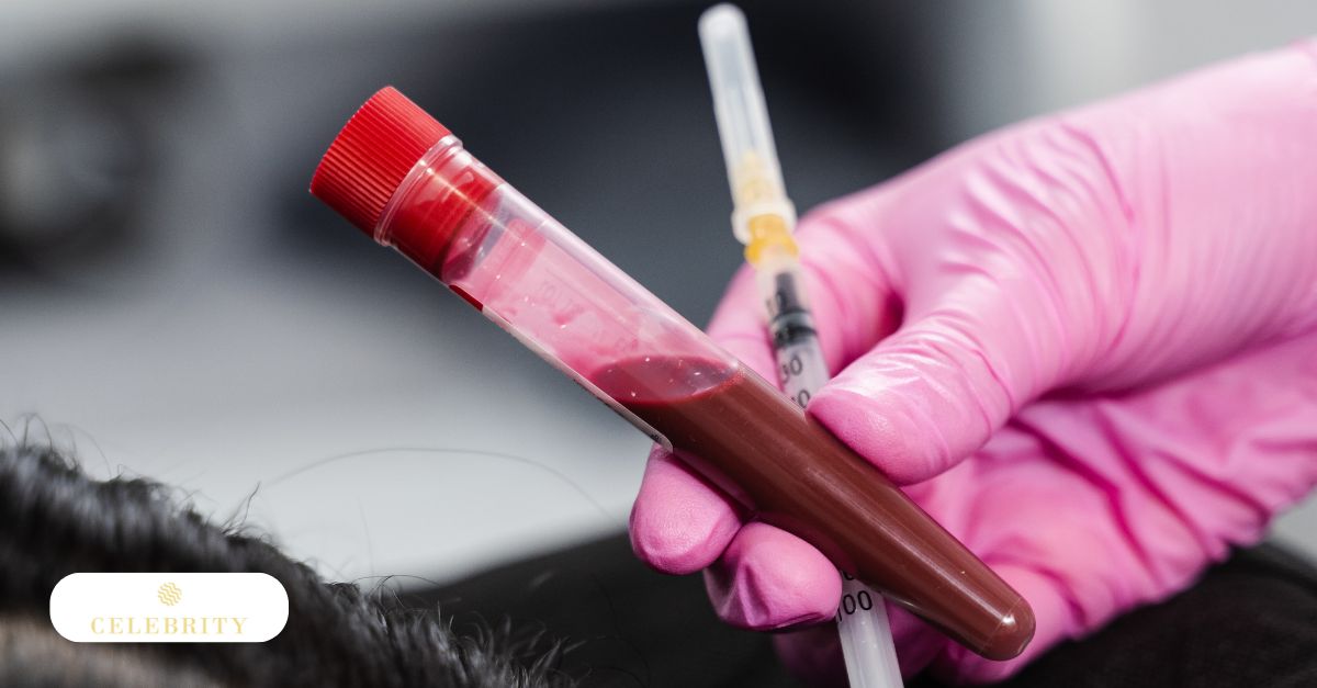 Professional PRP hair therapy setup illustrating safety-focused regenerative scalp treatment