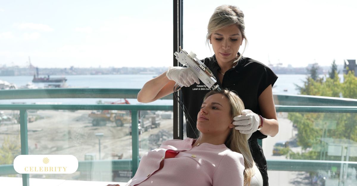 PRP hair treatment procedure at Celebrity Laser & Skin Care in North Vancouver