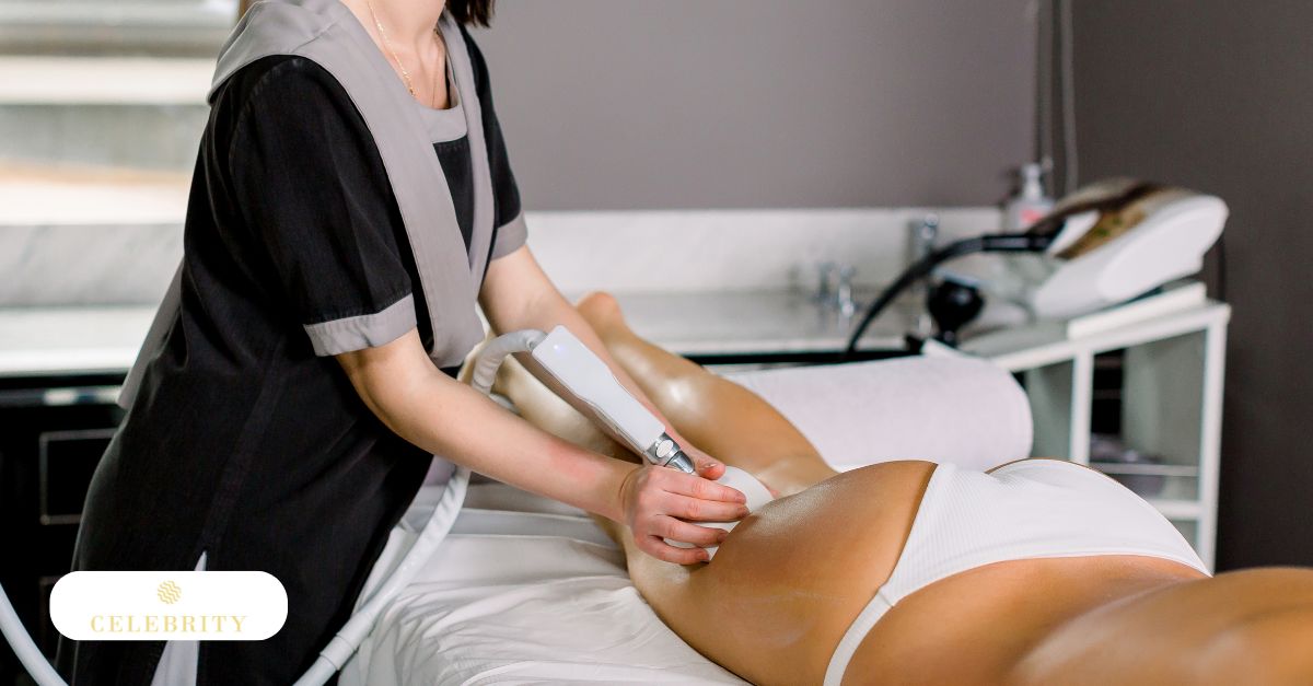 VelaShape II treatment being applied to the thigh to reduce the appearance of cellulite and improve skin smoothness