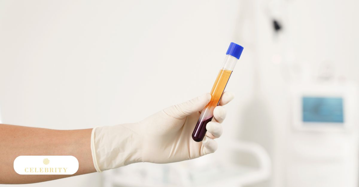 Platelet-rich plasma sample prepared for PRP hair loss treatment and regenerative scalp therapy