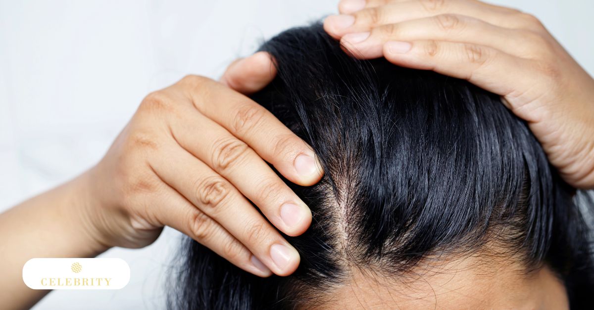 Person examining thinning hair and scalp condition, representing possible reduced PRP hair treatment results when aftercare instructions are not followed