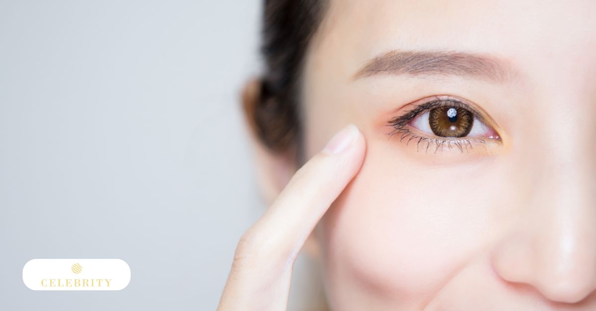 Smooth and brighter under-eye appearance after PRP treatment for under-eye rejuvenation