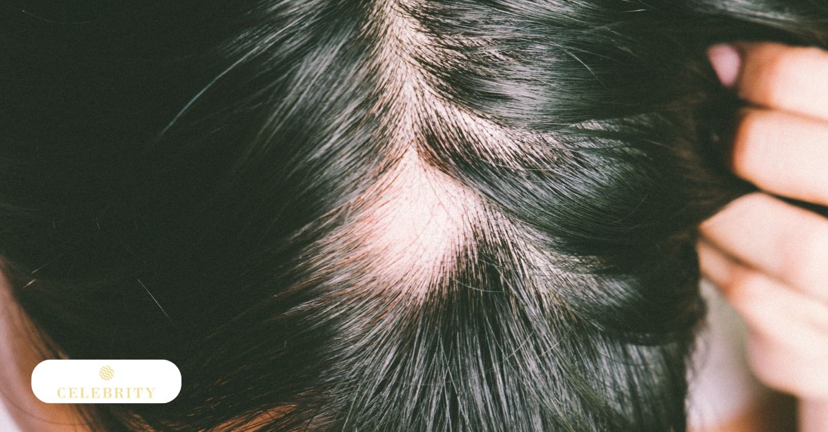 Close-up of scalp with visible thinning area illustrating follicle shrinkage in hair loss