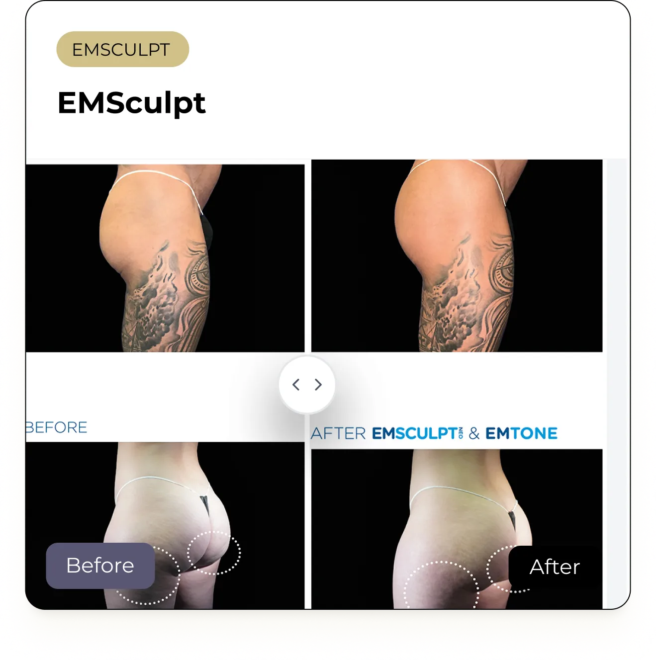 BeforeAfterCard (1)