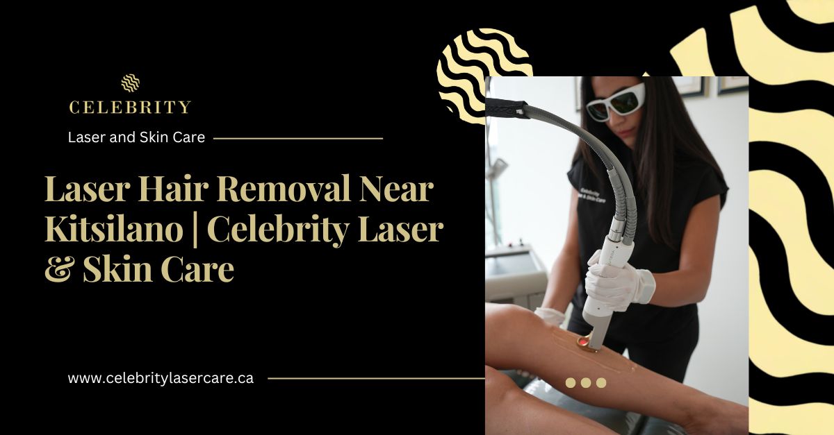 Laser Hair Removal Near Kitsilano
