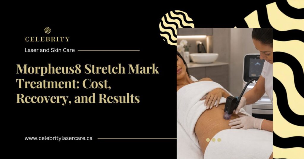 Morpheus8 for Stretch Marks: How RF Microneedling Helps Improve Stretch Marks