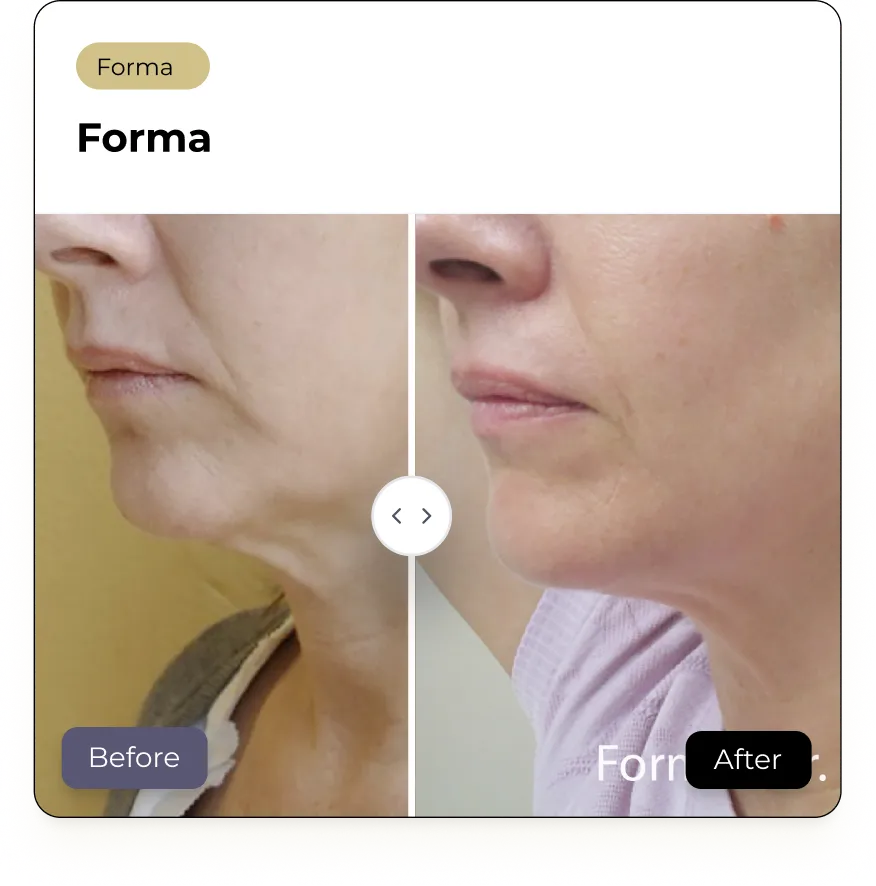 BeforeAfterCard (2)
